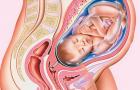 ორსულობა ტყუპებთან: პირველი ნიშნებიდან დაბადებამდე