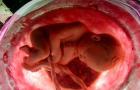 Druga nosečnost 38 tednov znanilci poroda